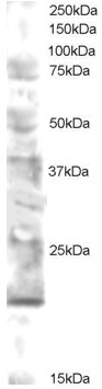 Goat Anti-UEV2V2  / MMS2 Antibody