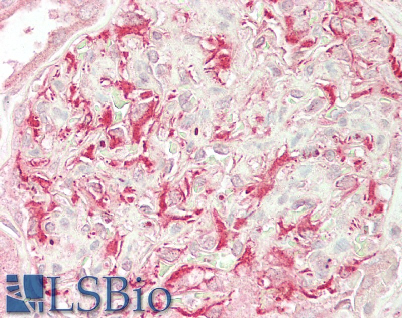 Goat Anti-Ulk3 (mouse) Antibody