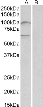 Goat Anti-UNC5B (aa629-643) Antibody