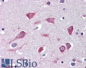 Goat Anti-USP31 Antibody