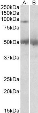 Goat Anti-USP6 / TRE2 / TRE17 Antibody