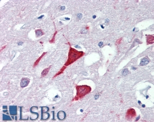 Goat Anti-USP9X Antibody