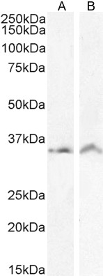 Goat Anti-VDAC2 (C Terminus) Antibody