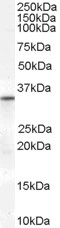 Goat Anti-VDAC2 (Internal) Antibody