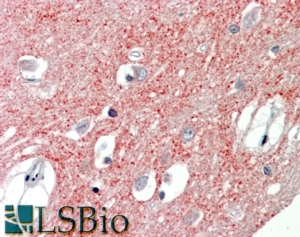 Goat Anti-VGLUT1 Antibody