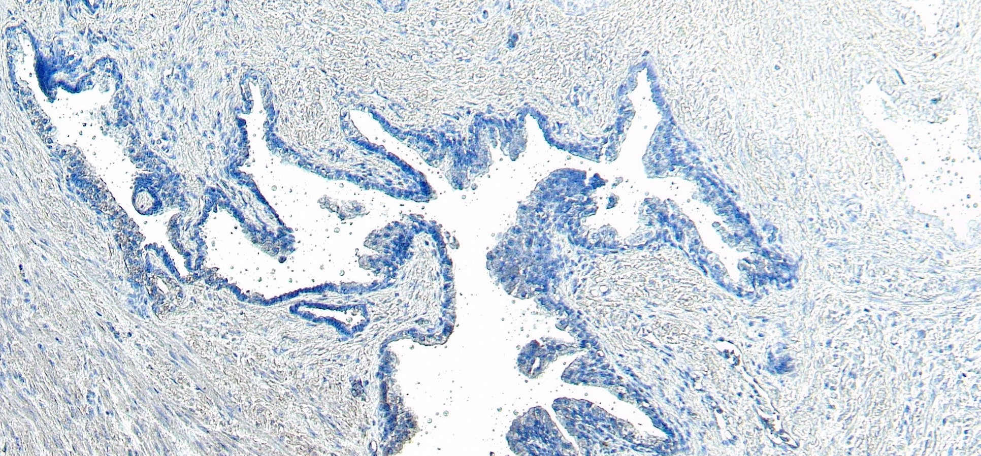 Goat Anti-VPS35 / MEM3 Antibody
