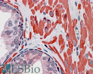 Goat Anti-VPS37C Antibody