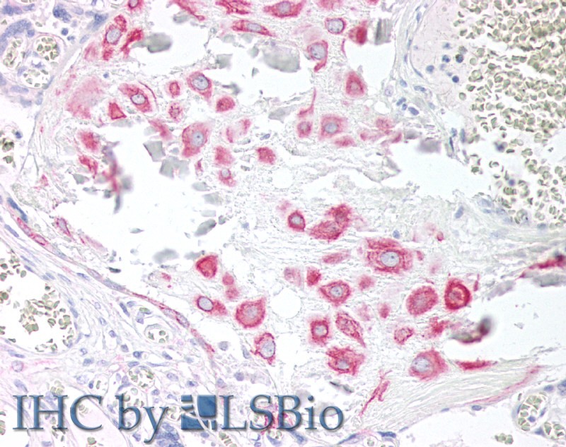 Goat Anti-VPS45 (C Terminus) Antibody