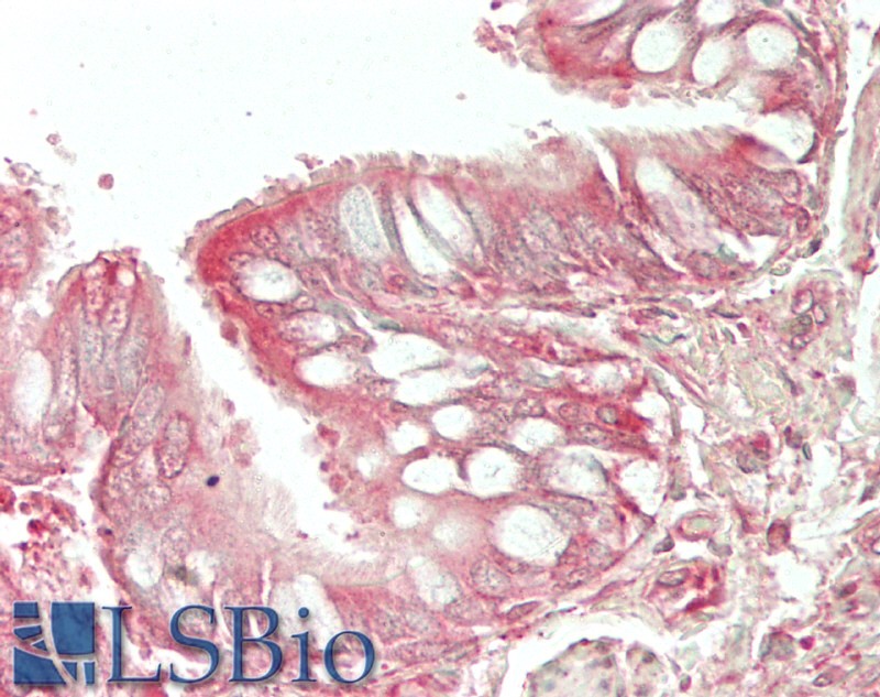 Goat Anti-Wfdc2 (mouse) Antibody