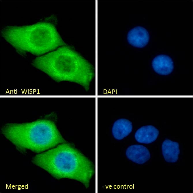 Goat Anti-WISP1 Antibody