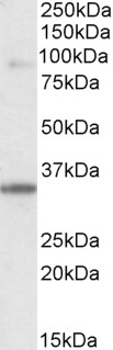 Goat Anti-ZASP/ CYPHER / LDB3 Antibody