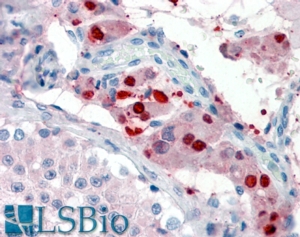 Goat Anti-ZBTB7B Antibody