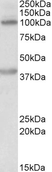 Goat Anti-ZEB2 (aa545-558) Antibody