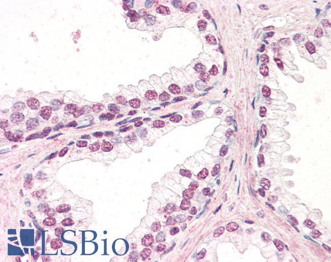 Goat Anti-ZIC5 Antibody