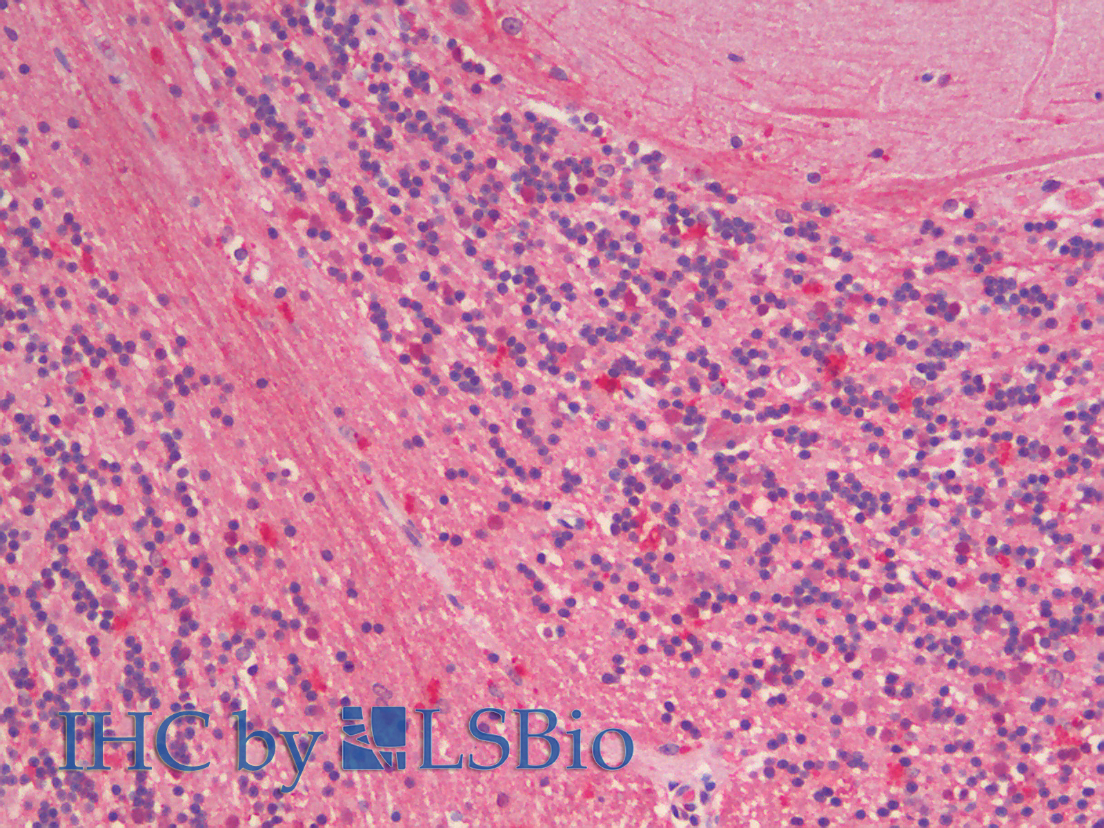 Goat Anti-ZNRF1 (mouse) Antibody