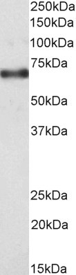 Positive Control Lysate for anti- IMP1/IGF2BP1 antibody