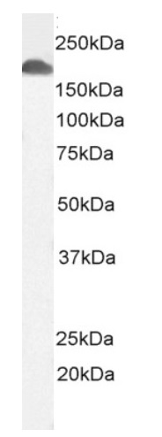 Positive Control Lysate for anti- ITGAL antibody