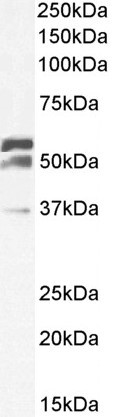 Positive Control Lysate for anti- TOM1L1 antibody