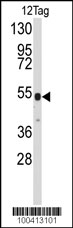 Rabbit Anti-V5 Tag Antibody