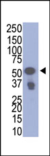 Rabbit Anti-VSV-g Tag Antibody